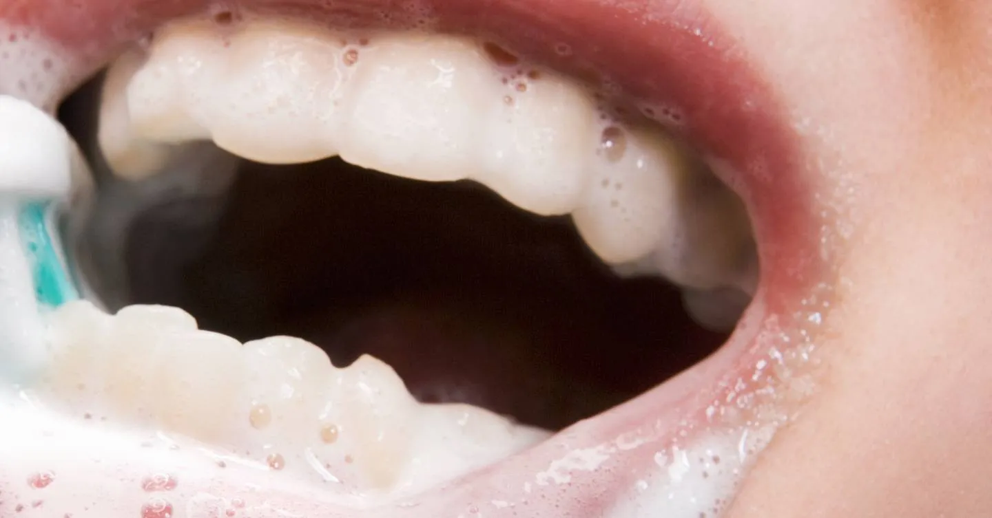 27415 teeth whitening frequency