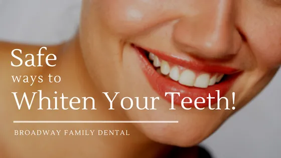 27415 teeth whitening ingredients