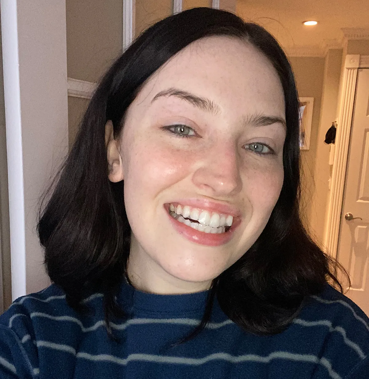 27420 whitening maintenance