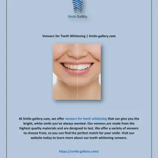 /img/27422-veneers-types.webp