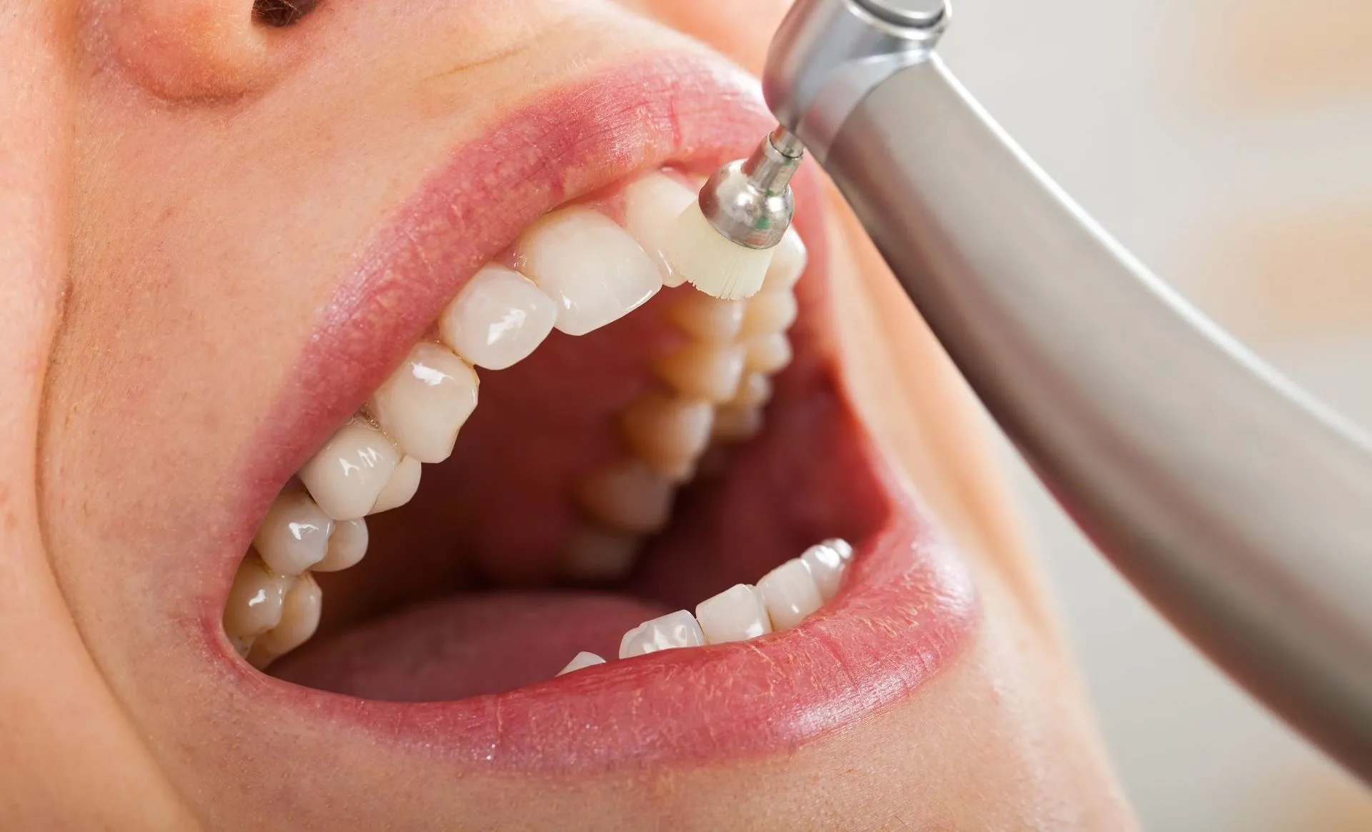 27452 hydrogen peroxide