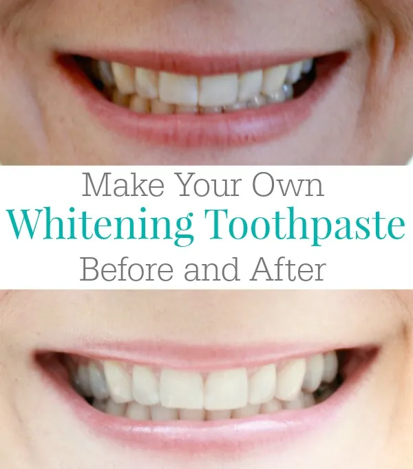 27463 deep stains toothpaste