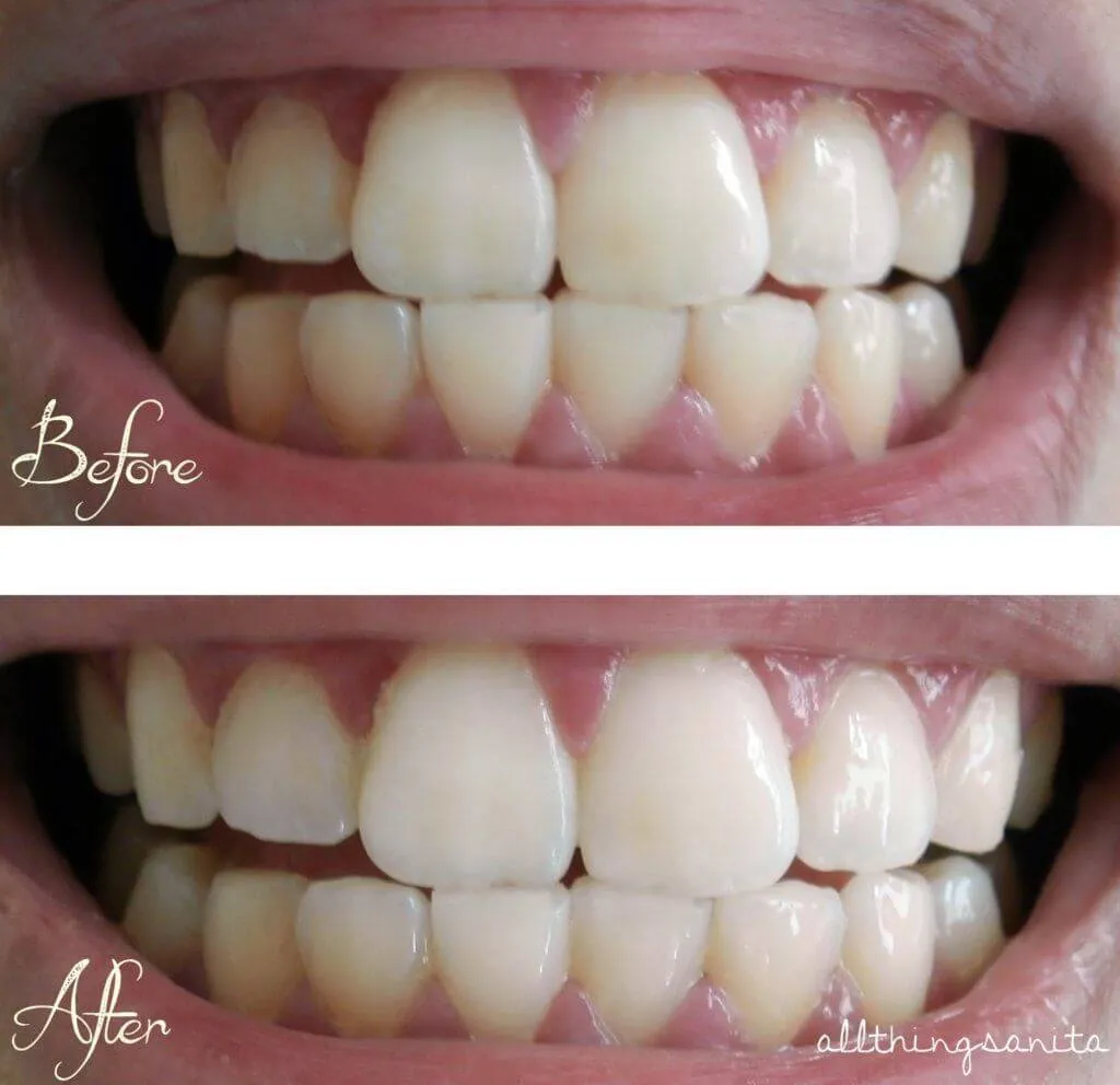 27463 ingredients whitening toothpaste