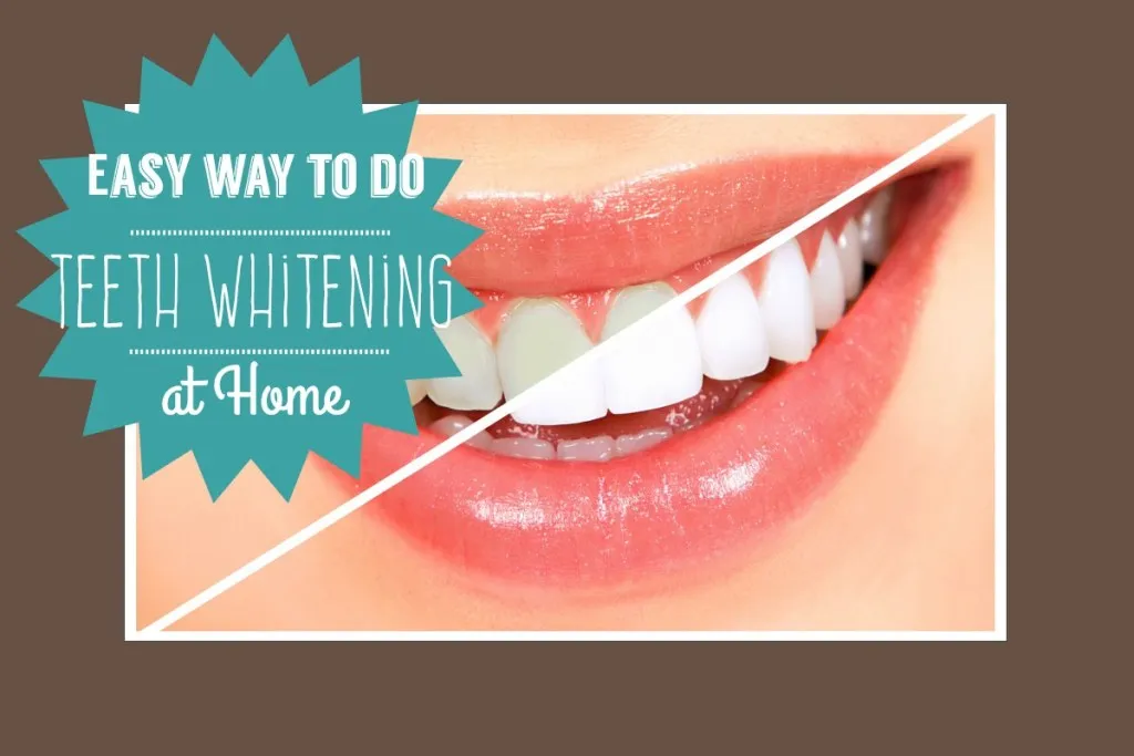 27464 over the counter whitening