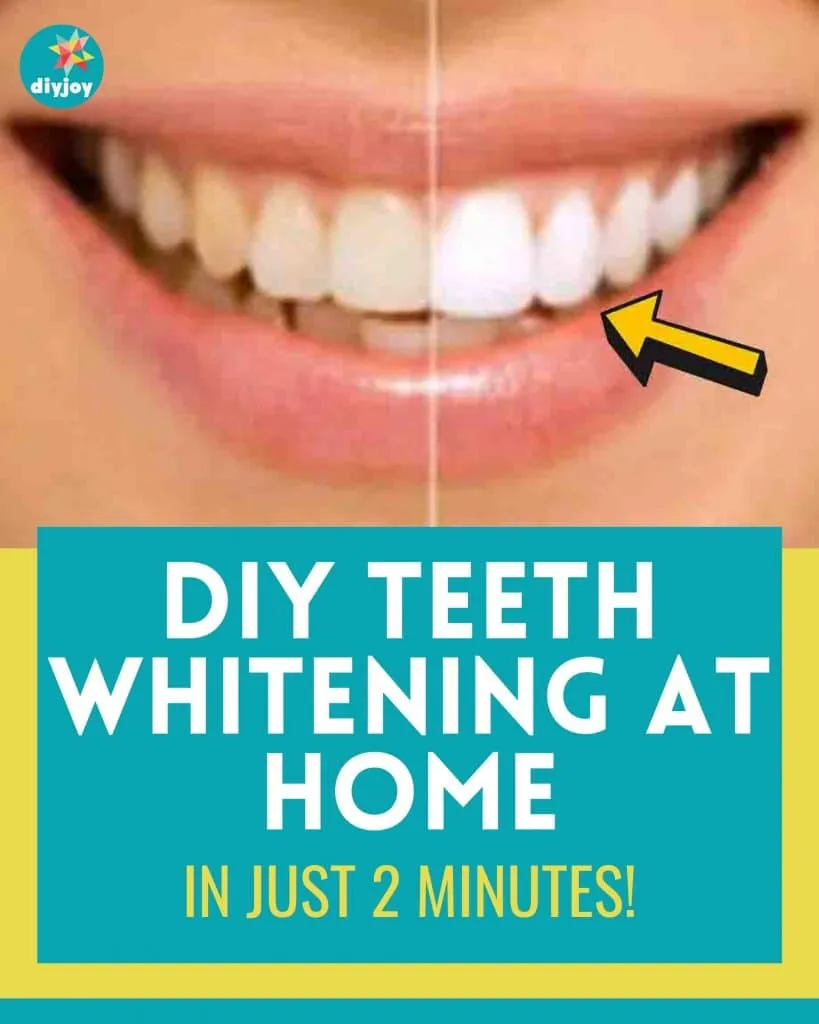 27470 baking soda lemon teeth whitening