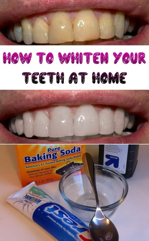 27470 turmeric teeth whitening