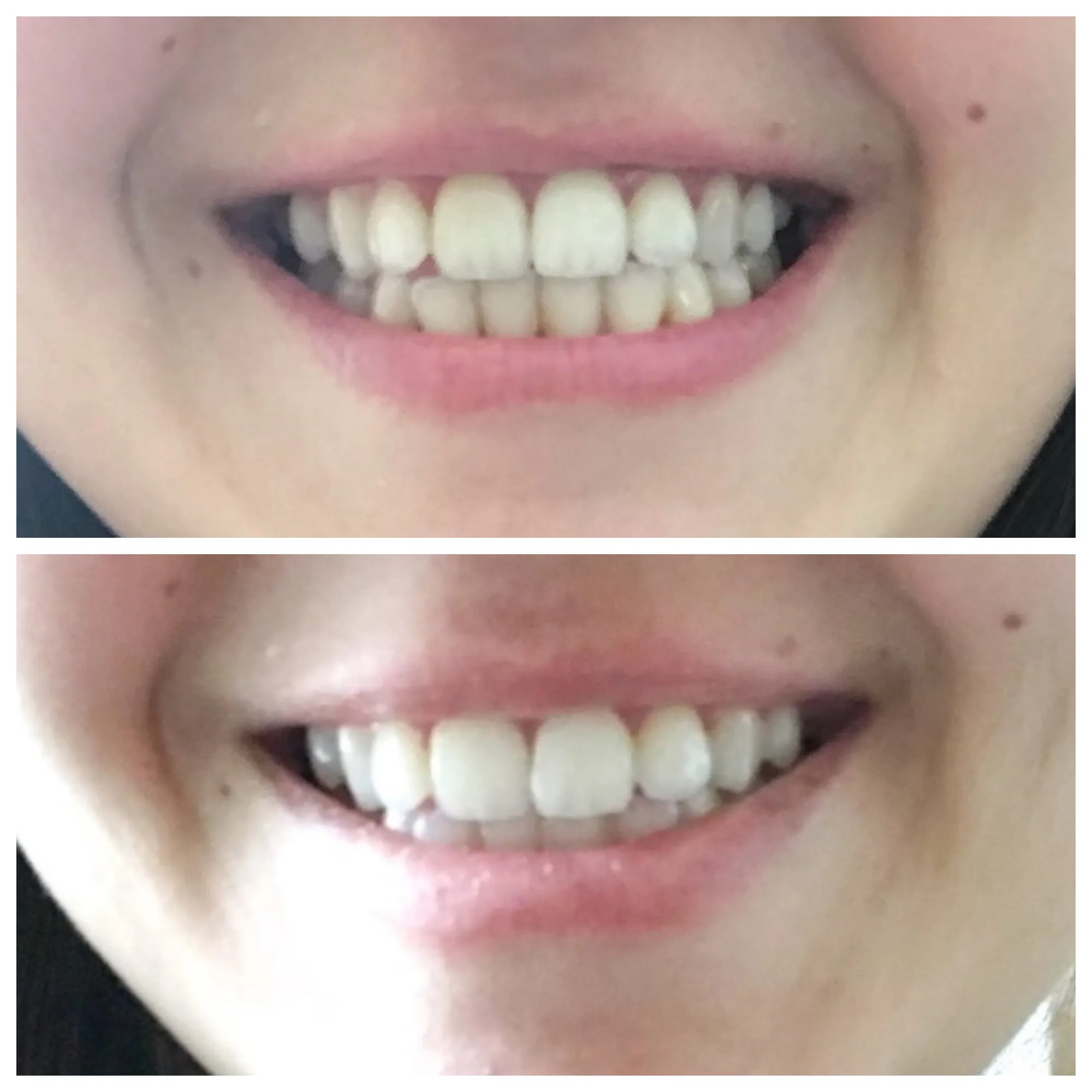 27474 healthy smile maintenance