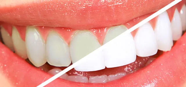 27479 bonding materials