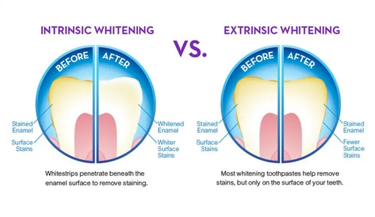 27479 professional teeth whitening