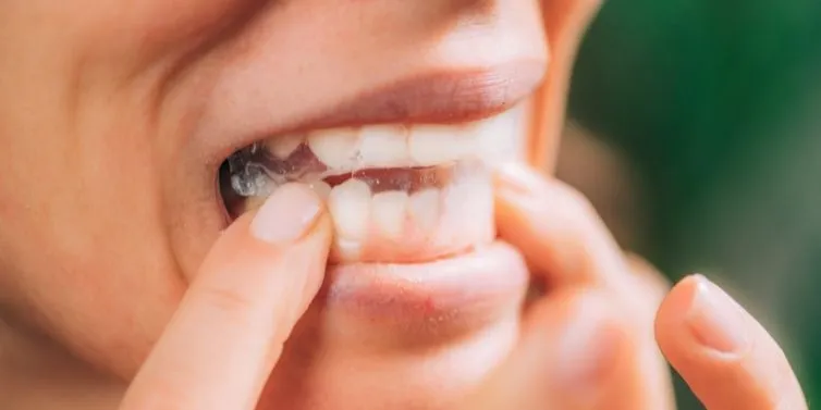 27479 teeth sensitivity