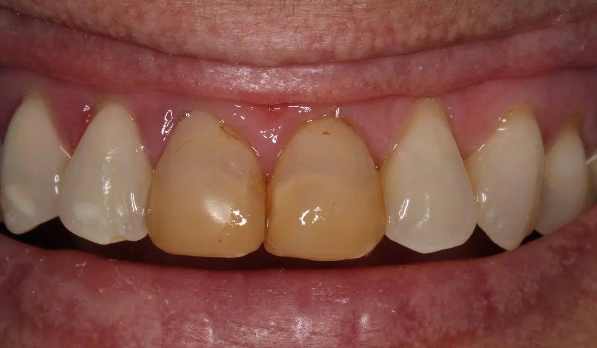 27490 kor whitening process