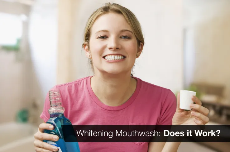 27497 teeth whitening process