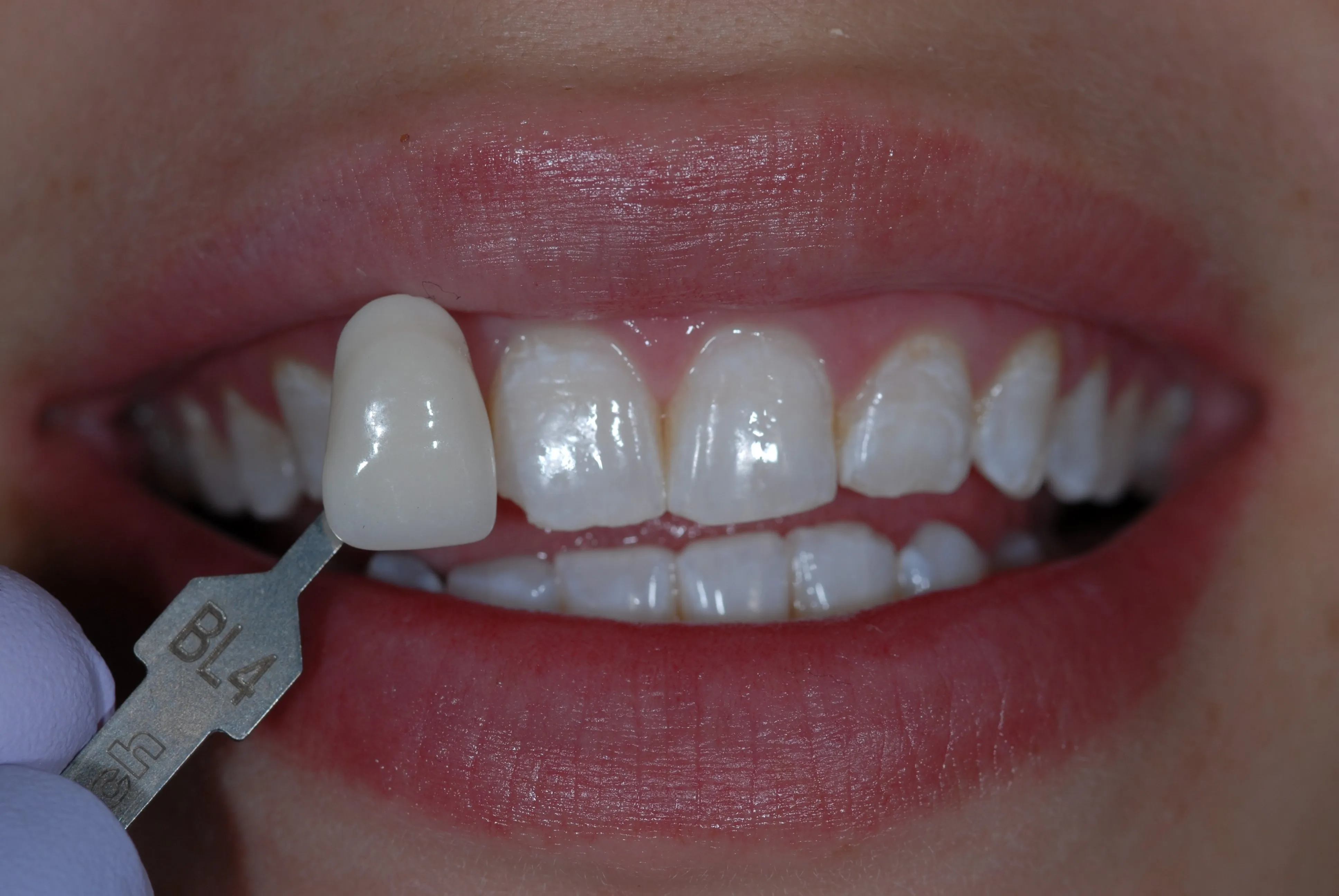 27502 citrus fruits teeth