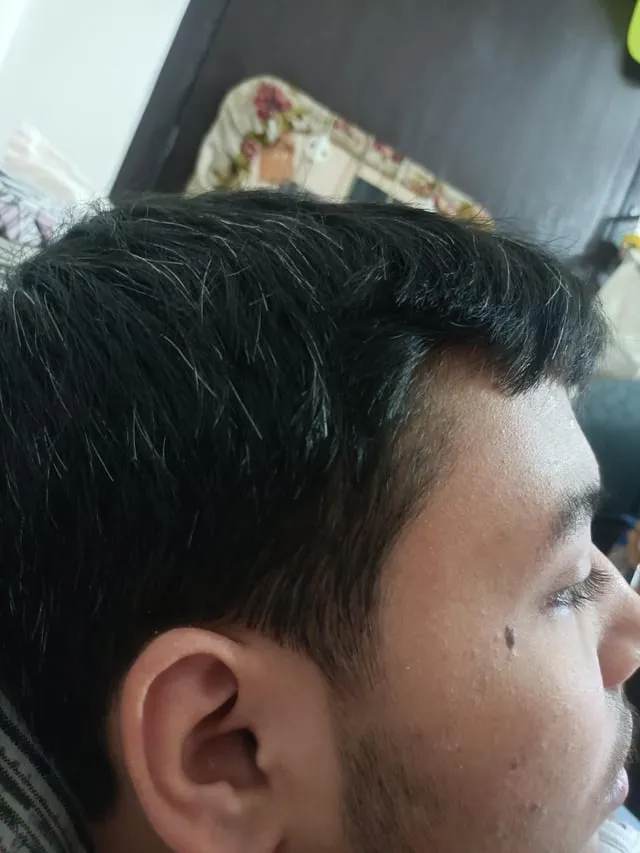 27504 balanced diet hair