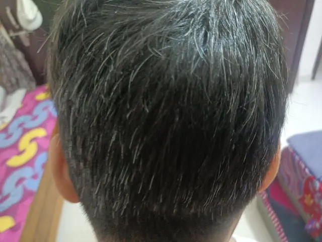 27504 manage stress hair