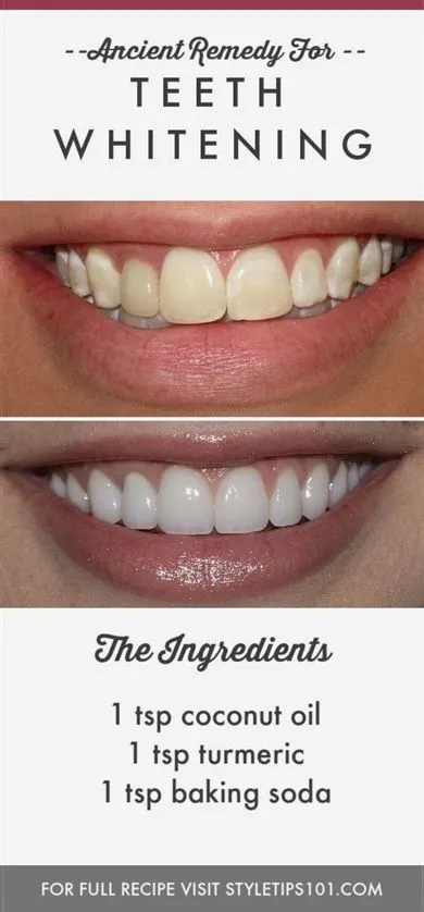 27506 enamel erosion