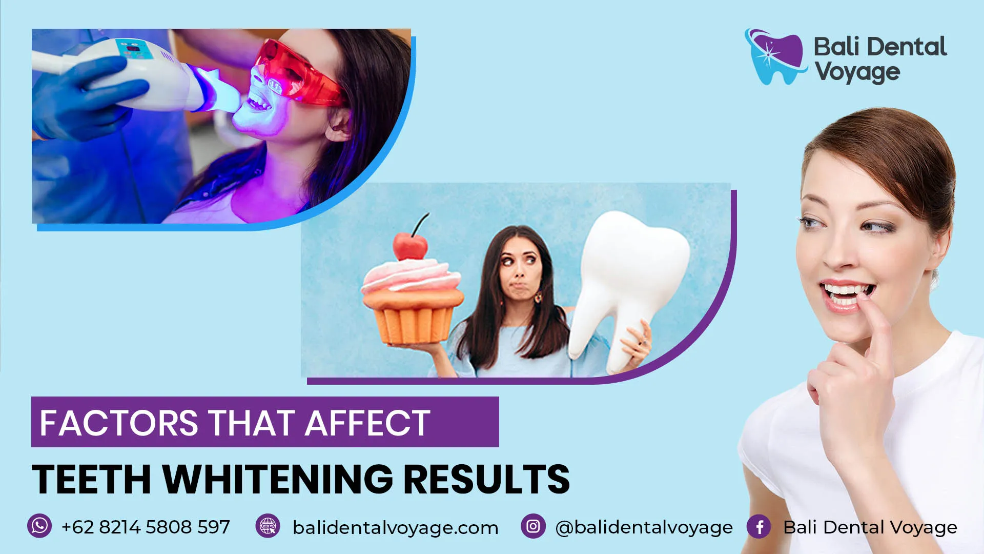 27517 teeth whitening maintenance