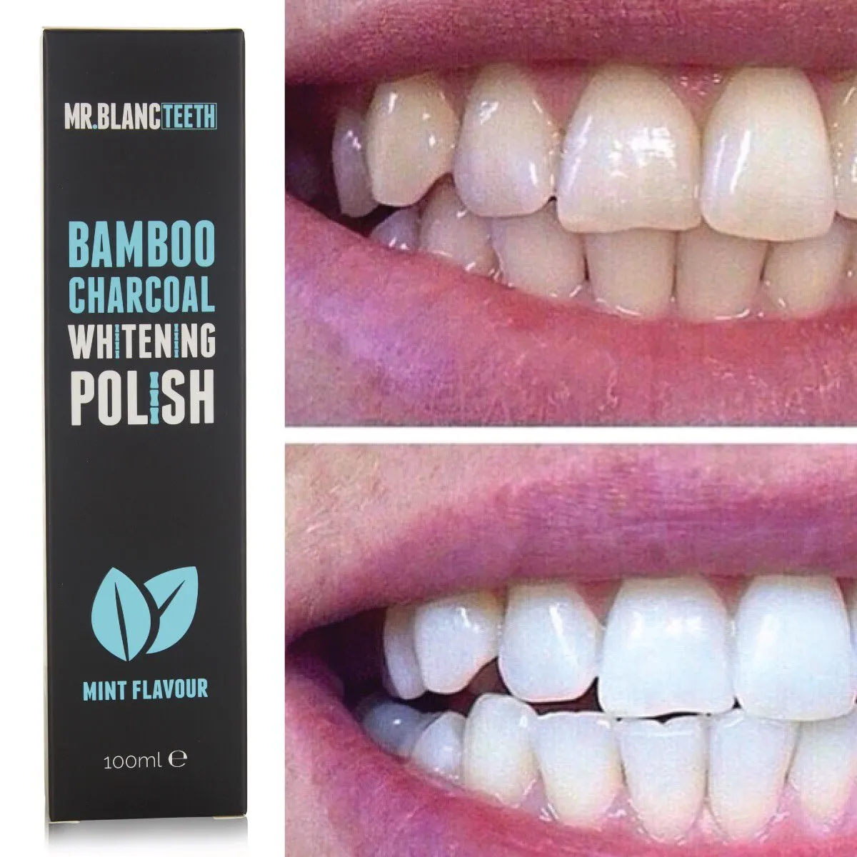 27518 mr blanc teeth whitening beauty store