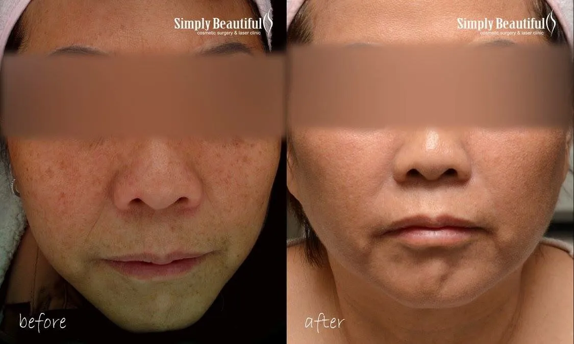 27527 topical creams for skin