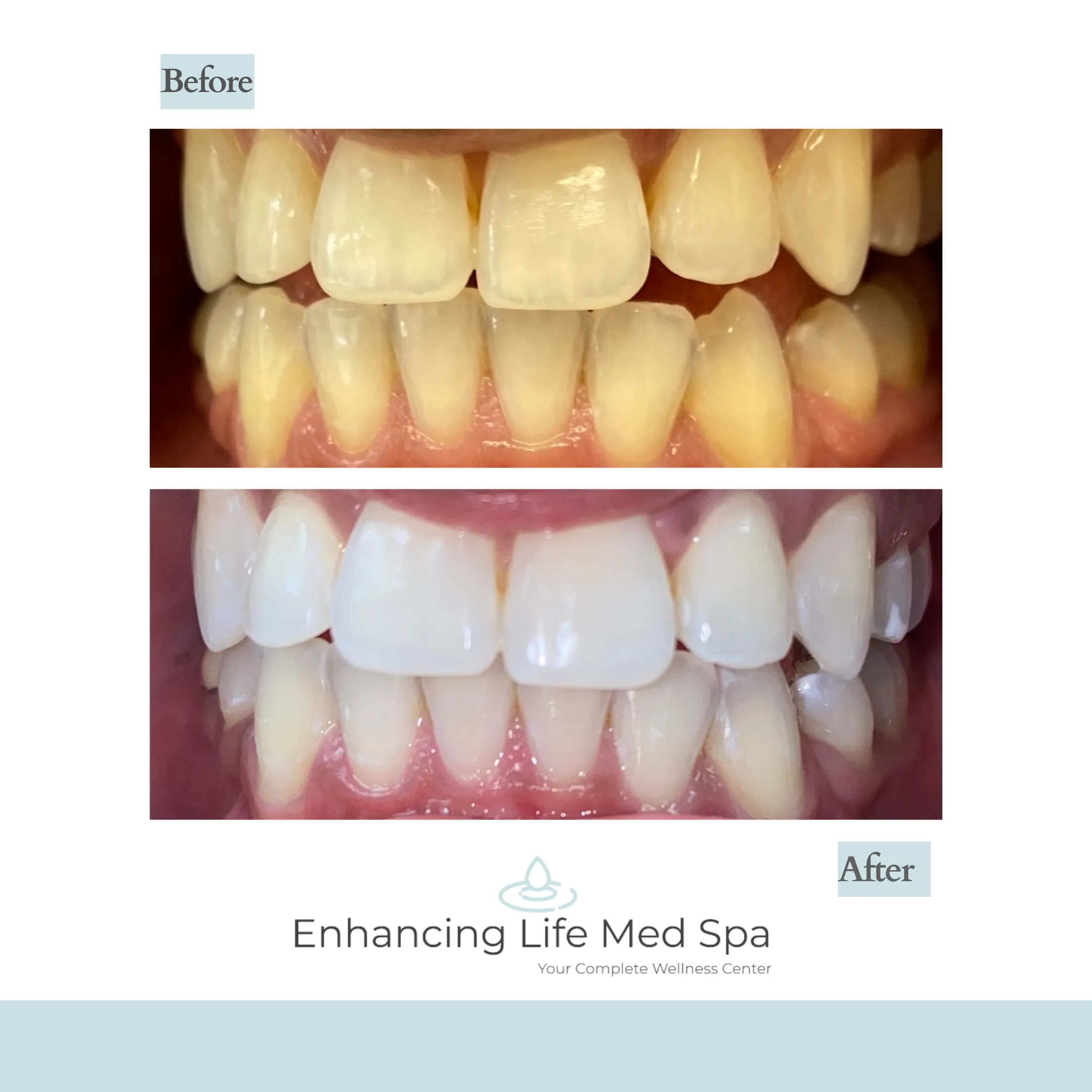 27560 whitening toothpaste